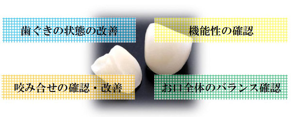 歯茎の状態改善　機能性の確認　噛み合わせの確認・改善　お口全体のバランス確認